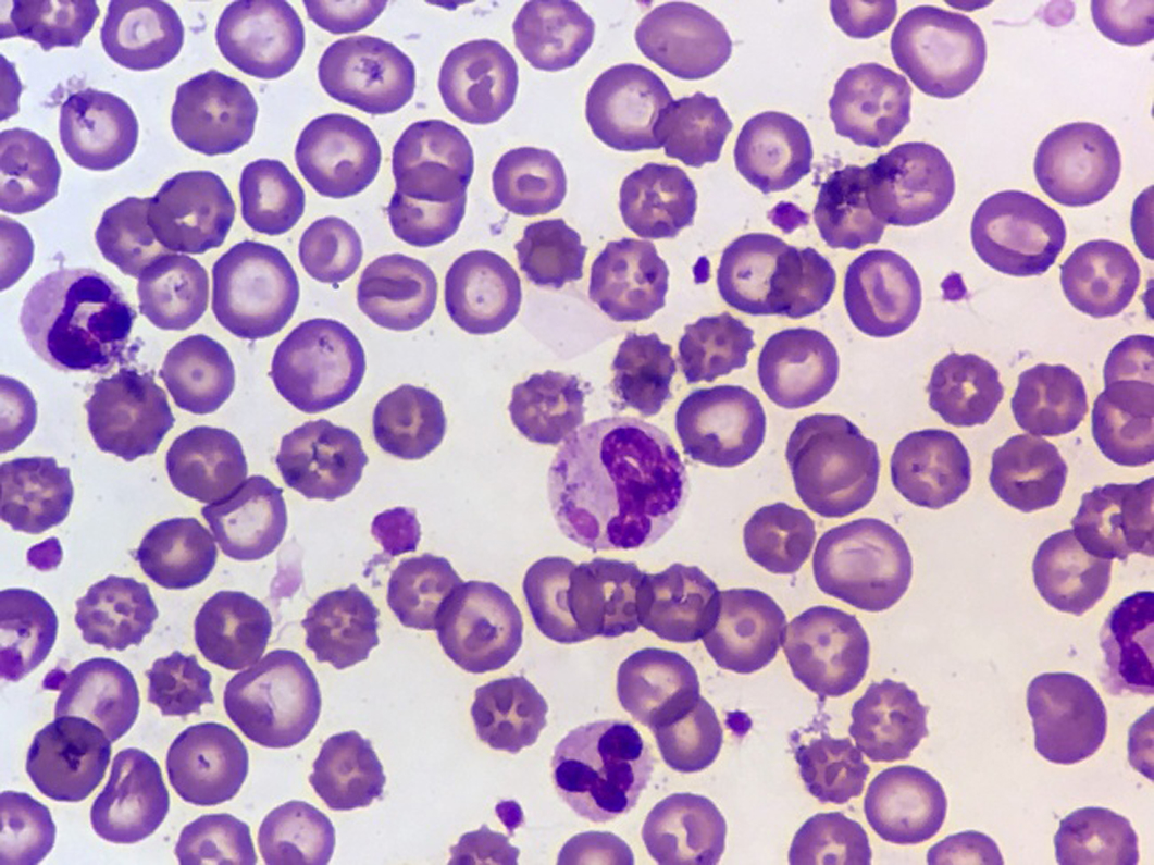 std diagnosis treatment in korea yezak urology seoul