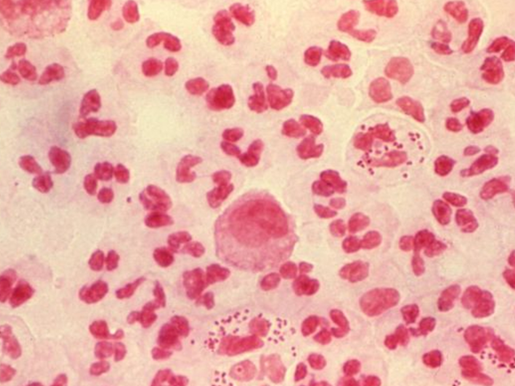 std diagnosis treatment in korea yezak urology seoul