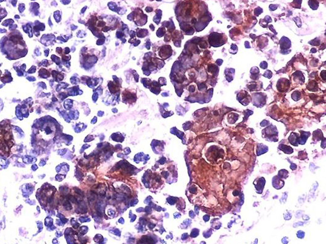 std diagnosis treatment in korea yezak urology seoul