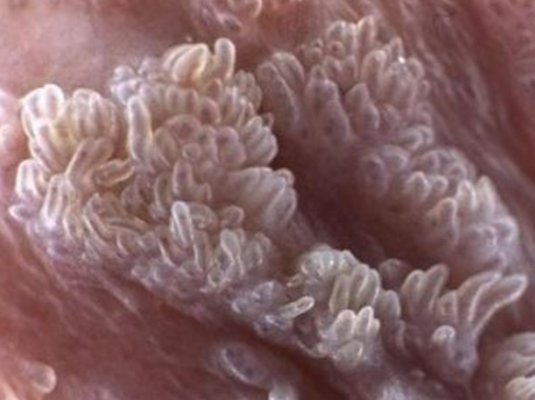 std diagnosis treatment in korea yezak urology seoul