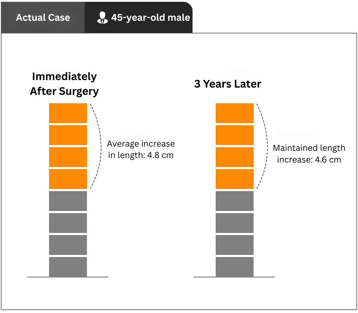 penis lengthening surgery in korea yezak urology clinic in seoul