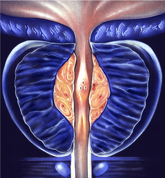 enlarged prostate treatment in korea yezak urology clinic in seoul