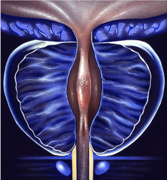 enlarged prostate treatment in korea yezak urology clinic in seoul